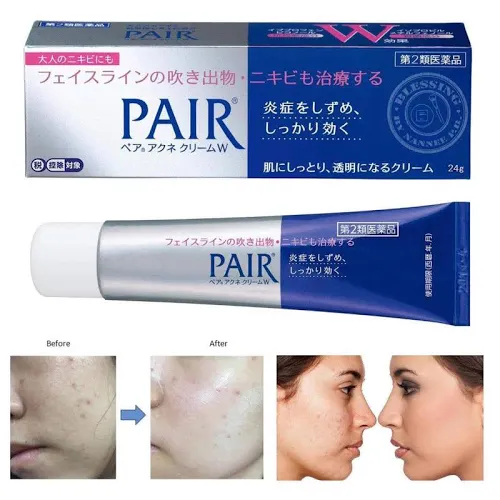 LION - Pair Acne Cream W, 24g