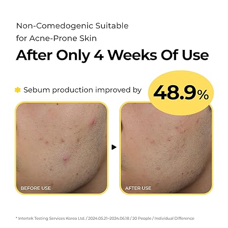 SINSURU - Sulfur Hot Spring Water 82% Soothing Serum