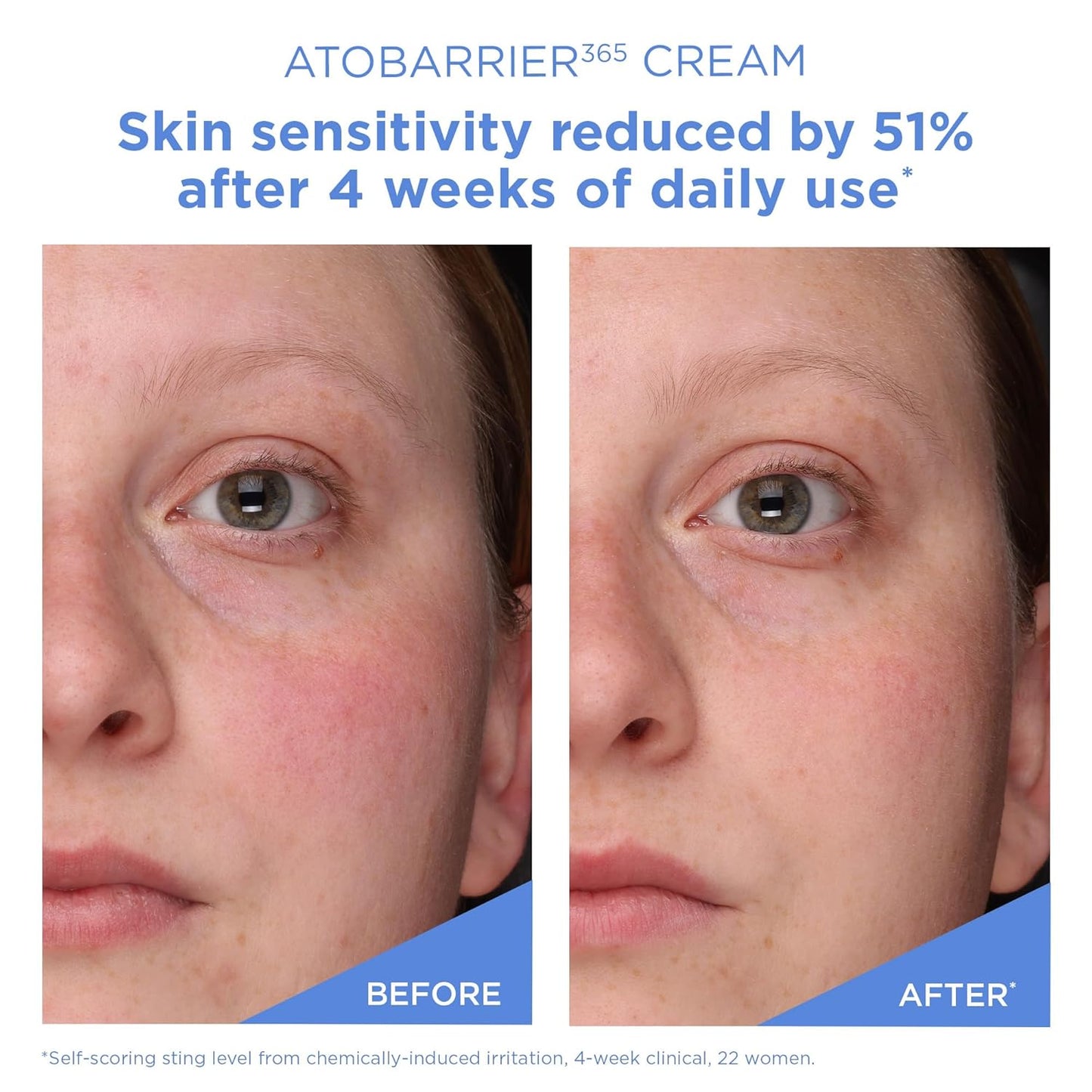 AESTURA - ATOBARRIER365 Cream 80ml