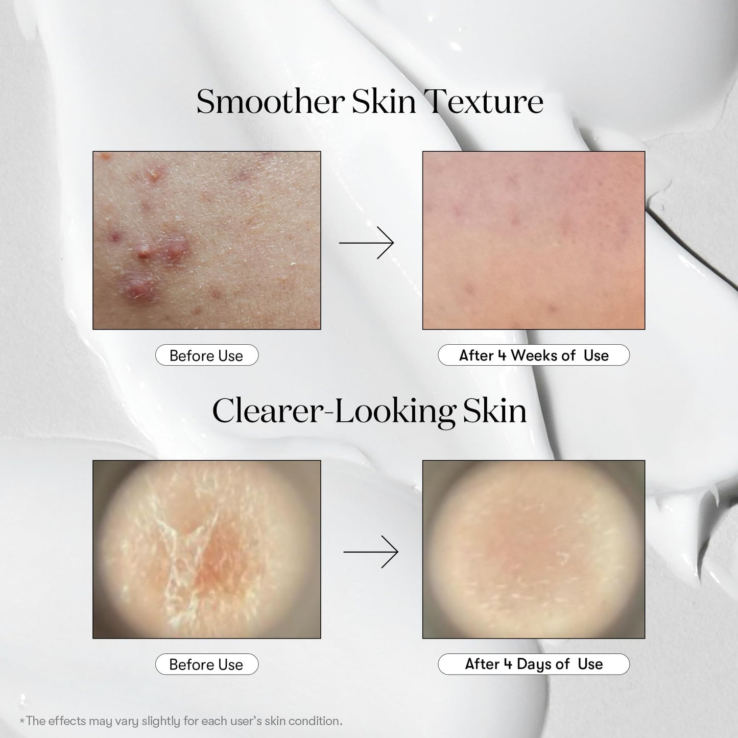 VT - Reedle Shot 100 Essence